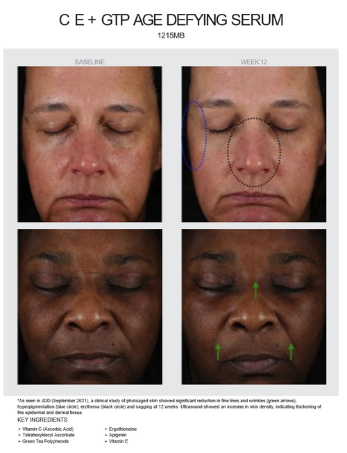 CE + GTP AGE DEFYING SERUM