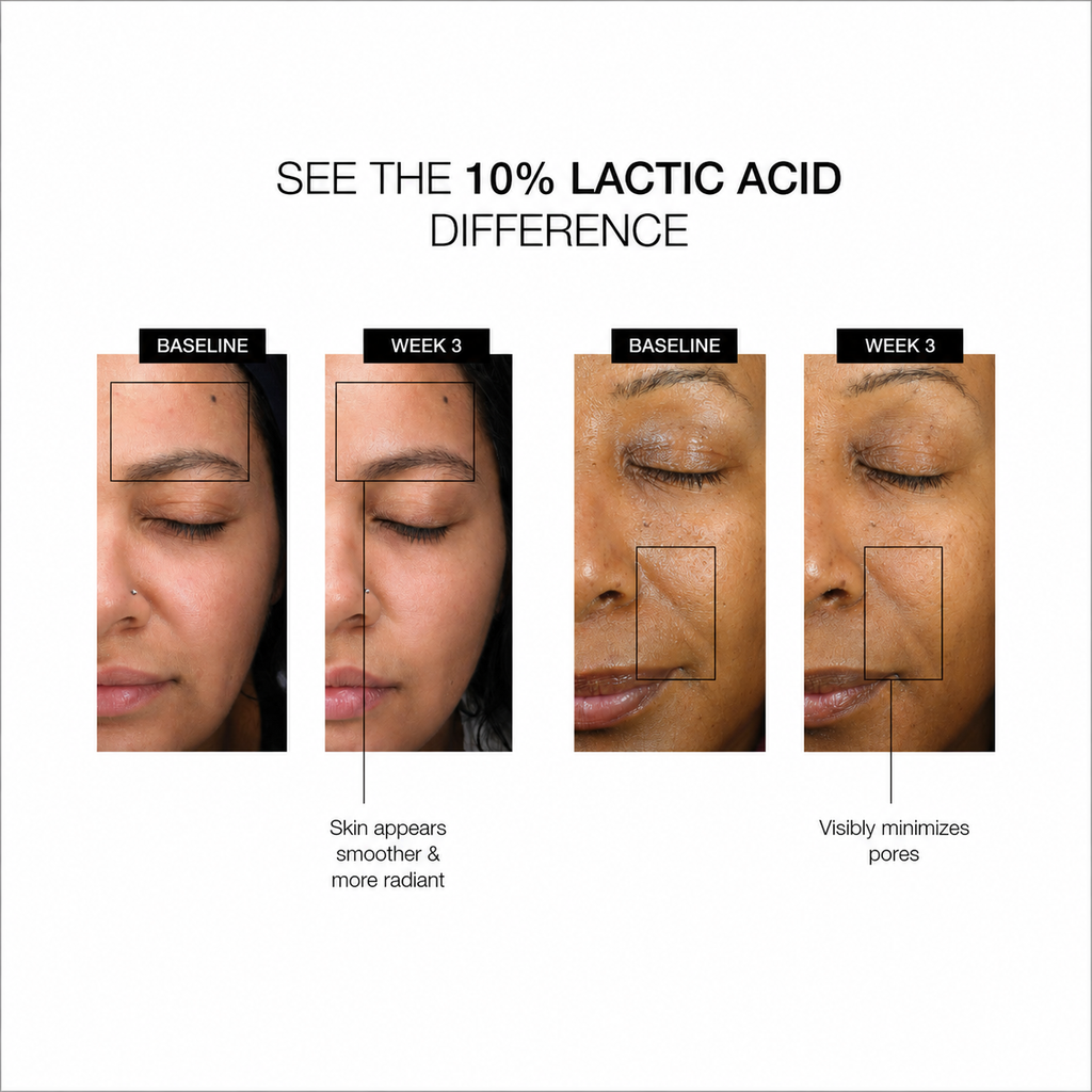 LACTIC ACID SERUM