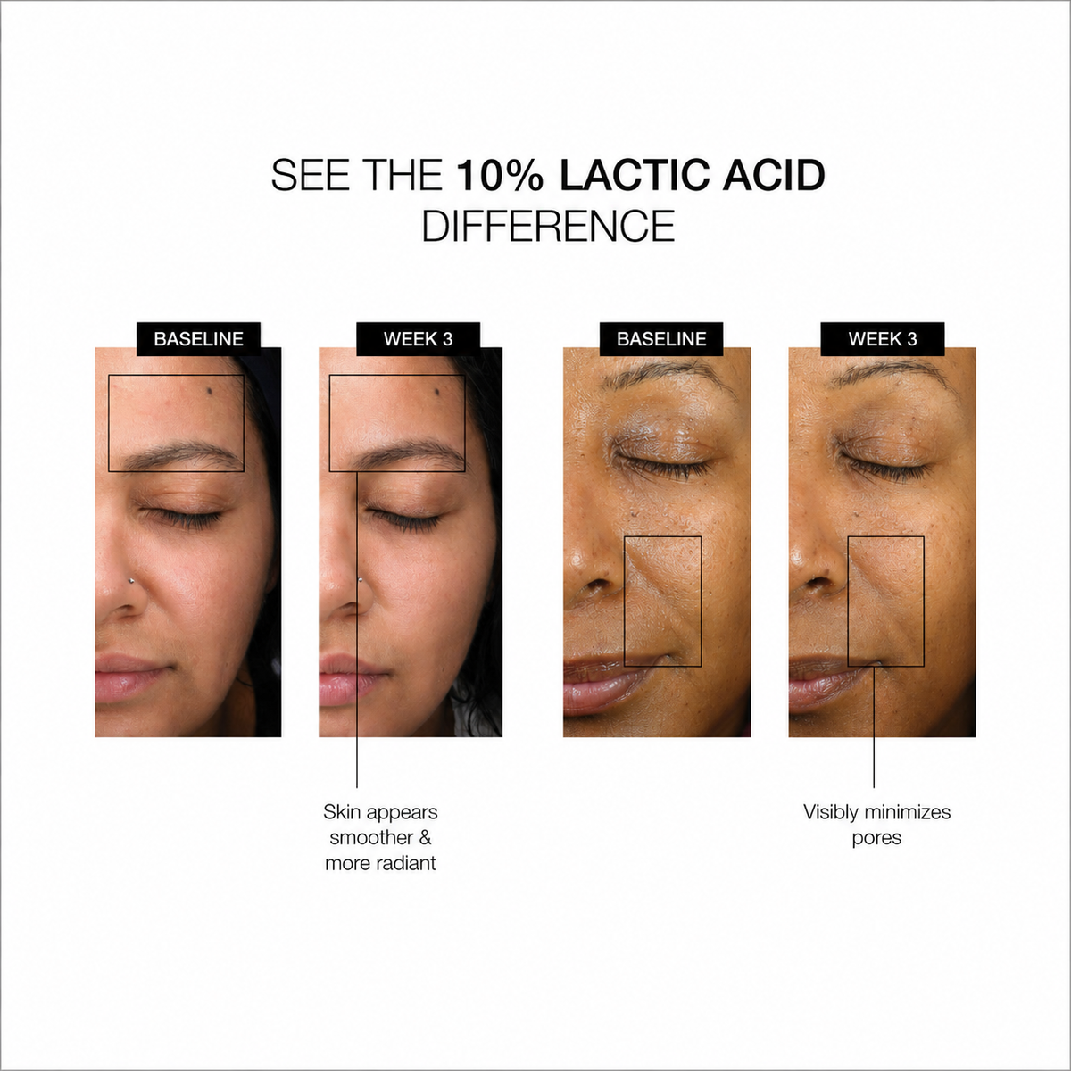 LACTIC ACID SERUM