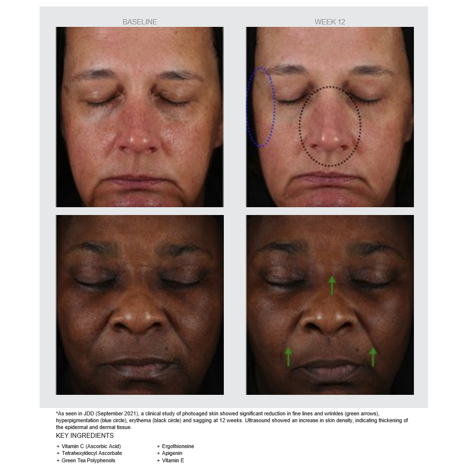 CE + GTP Age Defying Serum results: baseline and week 12
