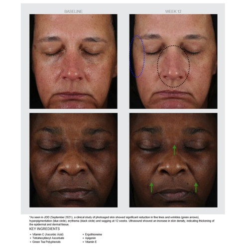 CE + GTP Age Defying Serum results: baseline and week 12