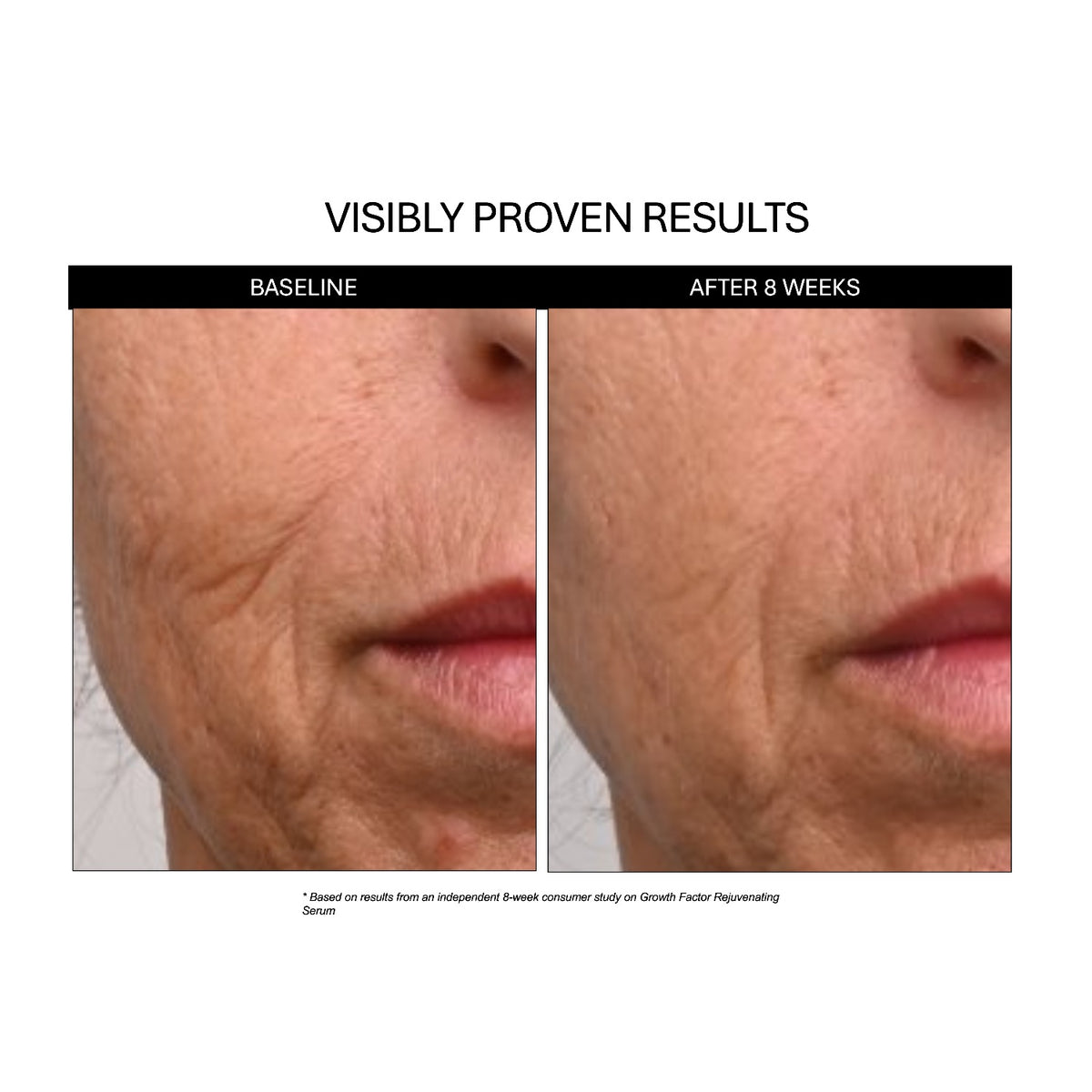 Rejuvenating Growth Factor Serum results: cheek and smile lines at baseline and after 8 weeks of use