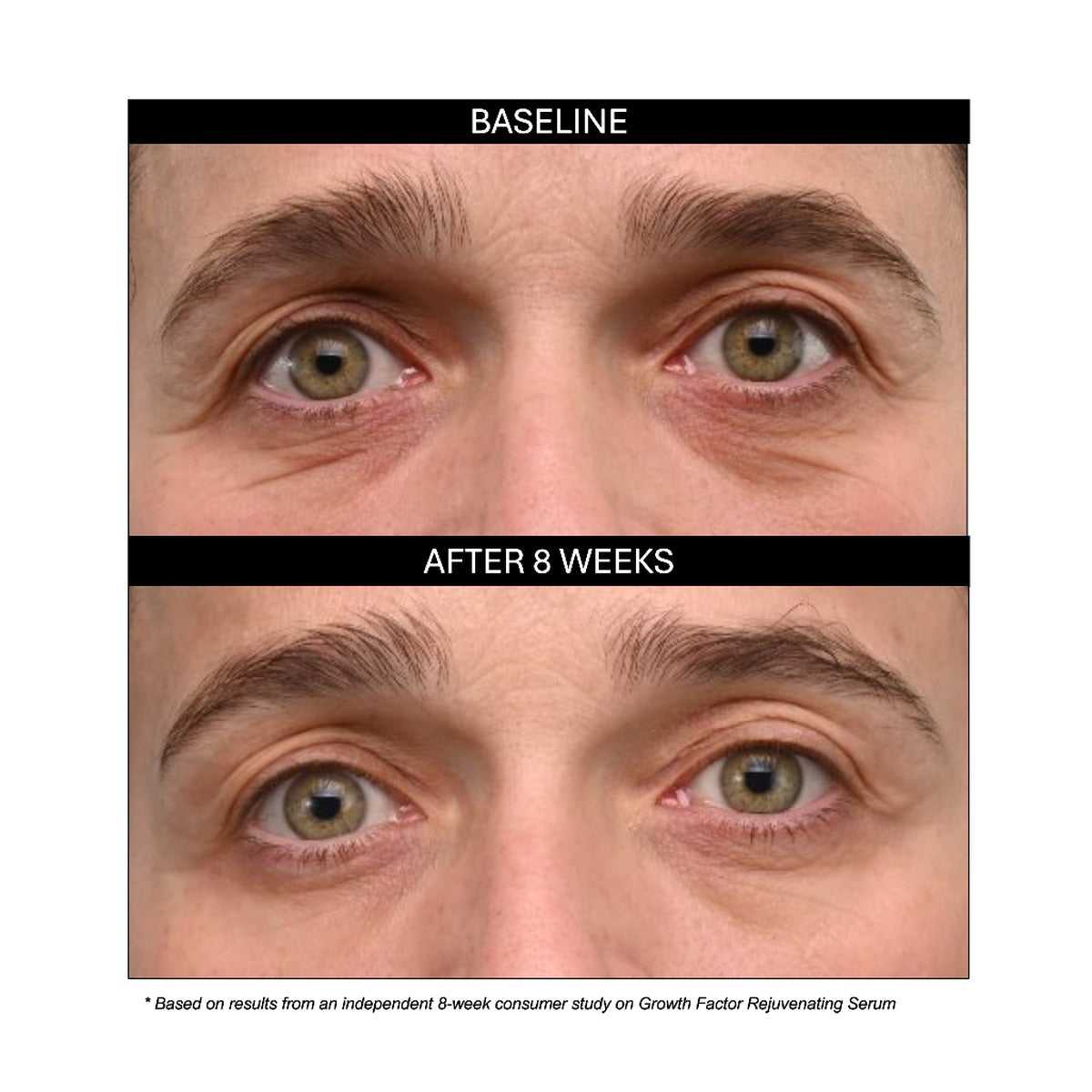 Rejuvenating Growth Factor Serum results: eye area at baseline and after 8 weeks of use