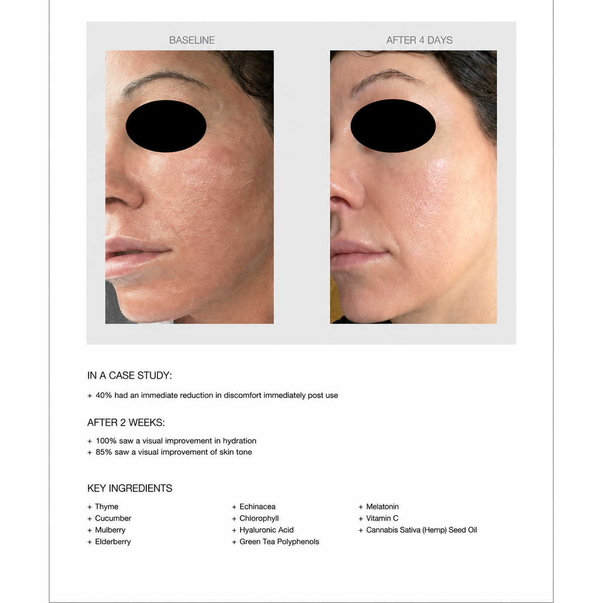 Phyto Calm & Correct Serum results: baseline and after 4 days, with key ingredients