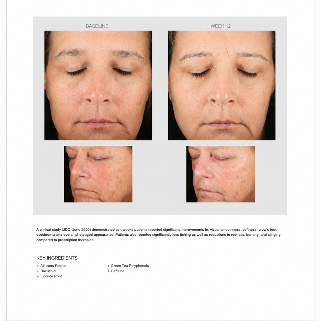Retinol PM TX Serum results: baseline and week 12, with key ingredients